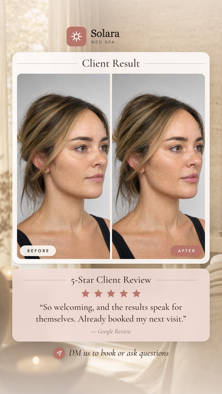 Example Story: the same review and the same before and after photos, with Solara Med Spa branding